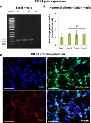 Magnetic activation of TREK1 triggers stress signalling and regulates neuronal branching in SH-SY5Y cells